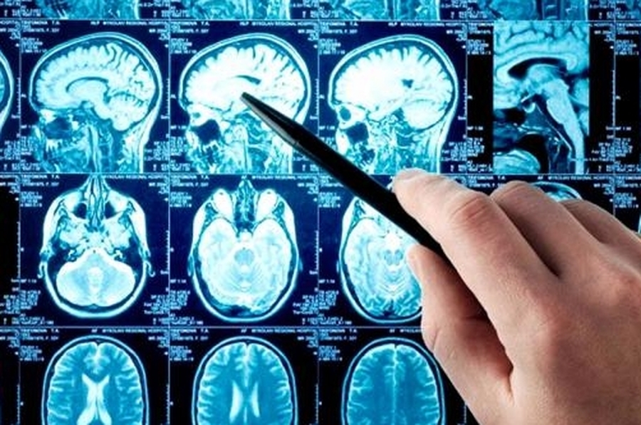 Científicos argentinos del Conicet diseñaron un asistente virtual para reconocer síntomas de ACV