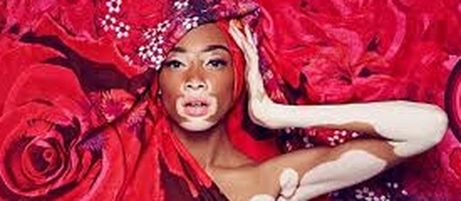 Día Mundial del Vitiligo