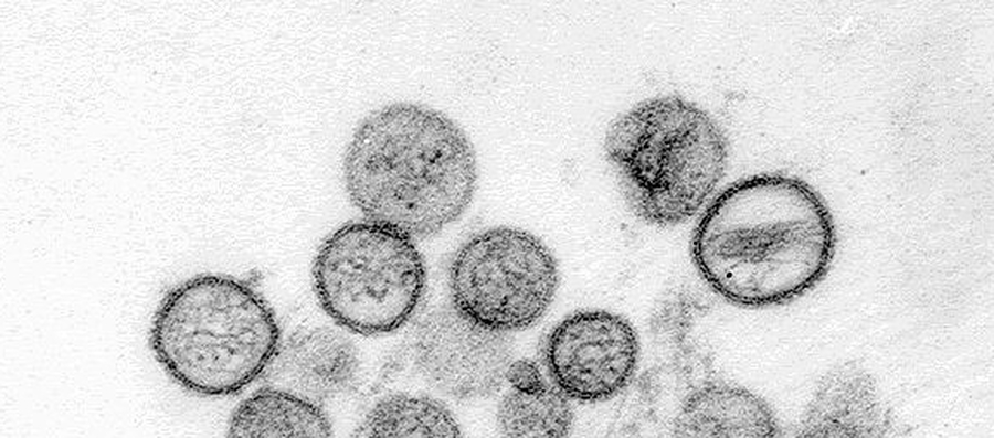 Recomendaciones para prevenir el hantavirus